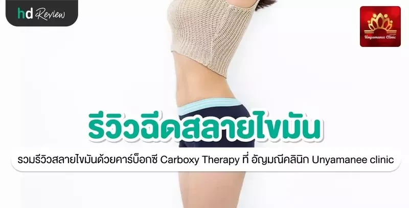 รีวิว สลายไขมัน ด้วยคาร์บ็อกซี Carboxy Therapy ที่ อัญมณีคลินิก Unyamanee clinic