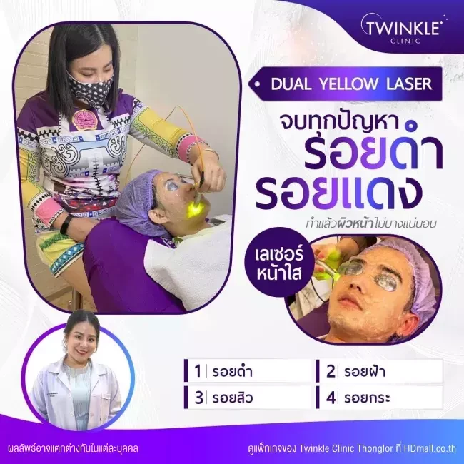 รีวิว Dual Yellow Laser ลดรอยดำ รอยแดงบนใบหน้า ที่ Twinkle Clinic Thonglor
