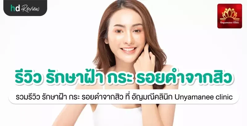 รีวิว รักษาฝ้า กระ รอยดำจากสิว