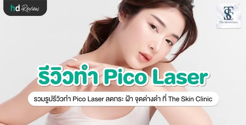 รีวิว Pico Laser ลดกระ ฝ้า จุดด่างดำ ที่ The Skin Clinic