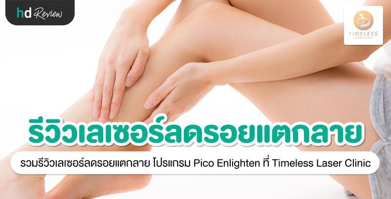 รีวิวเลเซอร์ลดรอยแตกลาย โปรแกรม Pico Enlighten ที่ Timeless Laser Clinic