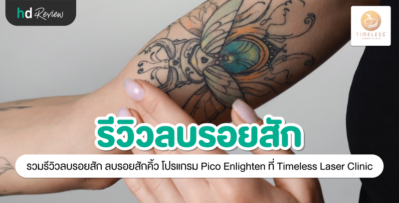 รีวิวลบรอยสัก ลบรอยสักคิ้ว โปรแกรม Pico Enlighten ที่ Timeless Laser Clinic