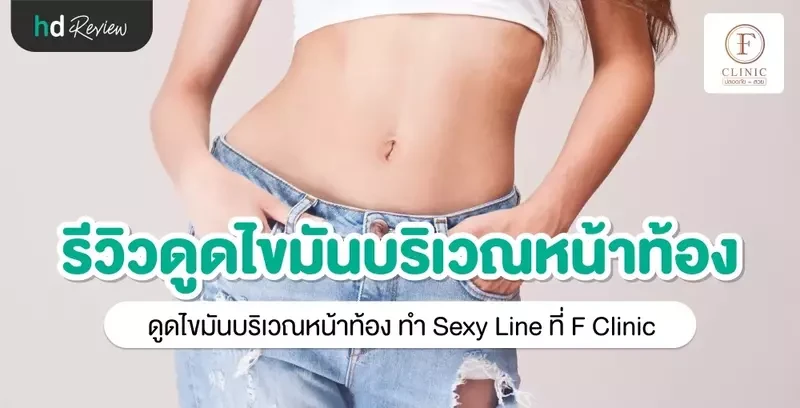 รีวิว ดูดไขมันบริเวณหน้าท้อง ทำ Sexy Line ที่ F Clinic