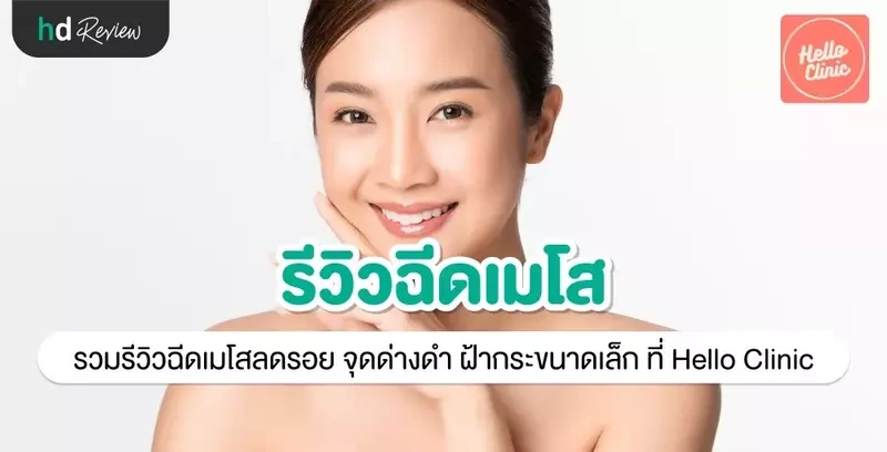 รีวิว ฉีดเมโสลดรอย จุดด่างดำ ฝ้ากระขนาดเล็ก ที่ Hello Clinic