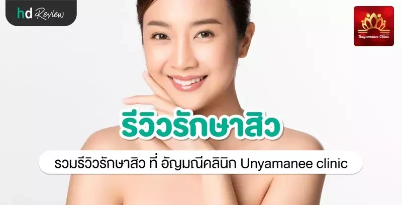 รีวิว รักษาสิว ที่ อัญมณีคลินิก Unyamanee clinic