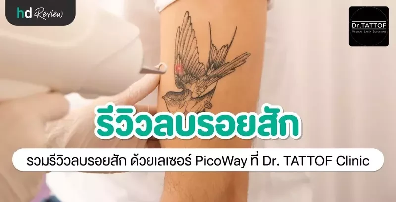 รีวิว ลบรอยสัก ด้วยเลเซอร์ PicoWay ที่ Dr. TATTOF Clinic