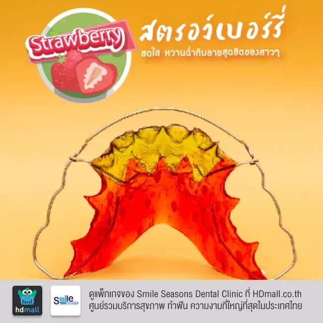 ตัวอย่างรีเทนเนอร์ ที่ Smile Seasons Dental Clinic (คลินิกทันตกรรมสไมล์ซีซันส์)