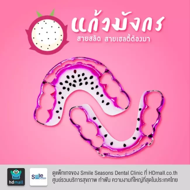 ตัวอย่างรีเทนเนอร์ ที่ Smile Seasons Dental Clinic (คลินิกทันตกรรมสไมล์ซีซันส์)