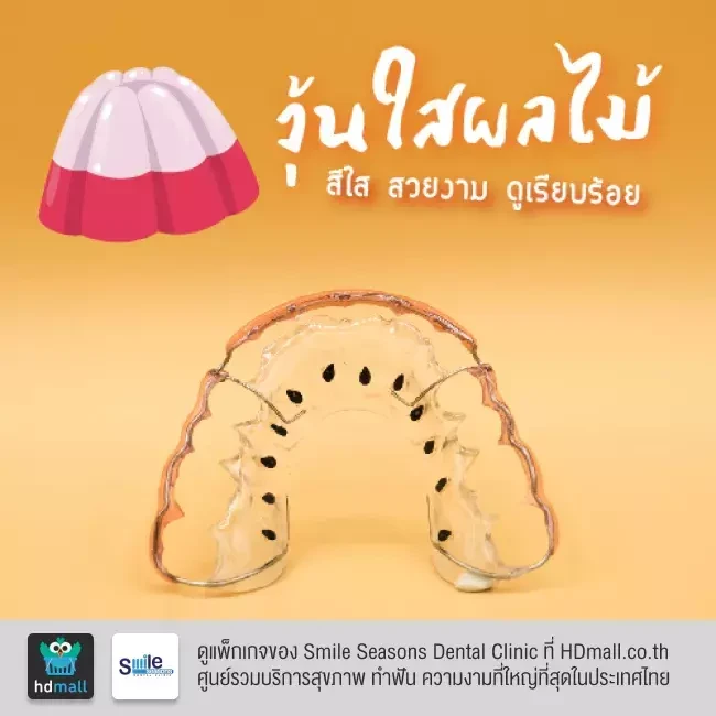 ตัวอย่างรีเทนเนอร์ ที่ Smile Seasons Dental Clinic (คลินิกทันตกรรมสไมล์ซีซันส์)