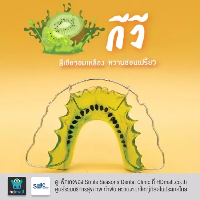 ตัวอย่างรีเทนเนอร์ ที่ Smile Seasons Dental Clinic (คลินิกทันตกรรมสไมล์ซีซันส์)