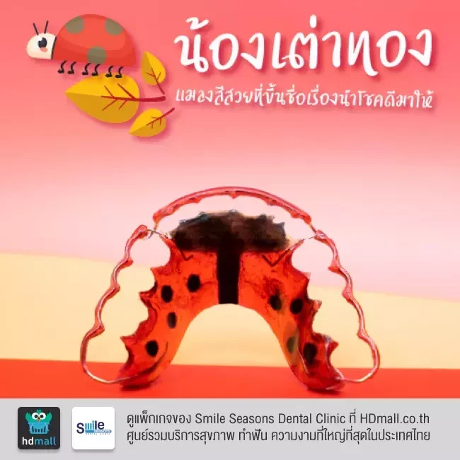 ตัวอย่างรีเทนเนอร์ ที่ Smile Seasons Dental Clinic (คลินิกทันตกรรมสไมล์ซีซันส์)