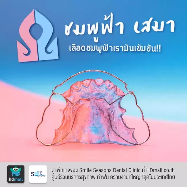 ตัวอย่างรีเทนเนอร์ ที่ Smile Seasons Dental Clinic (คลินิกทันตกรรมสไมล์ซีซันส์)