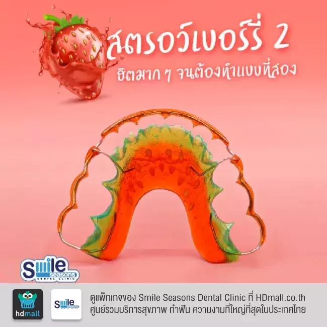 ตัวอย่างรีเทนเนอร์ ที่ Smile Seasons Dental Clinic (คลินิกทันตกรรมสไมล์ซีซันส์)