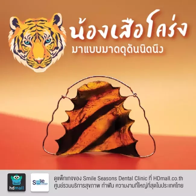 ตัวอย่างรีเทนเนอร์ ที่ Smile Seasons Dental Clinic (คลินิกทันตกรรมสไมล์ซีซันส์)