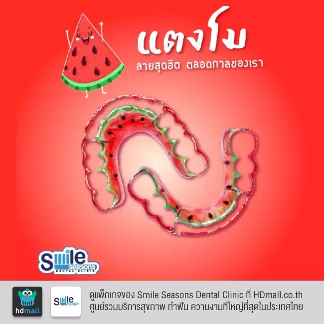ตัวอย่างรีเทนเนอร์ ที่ Smile Seasons Dental Clinic (คลินิกทันตกรรมสไมล์ซีซันส์)