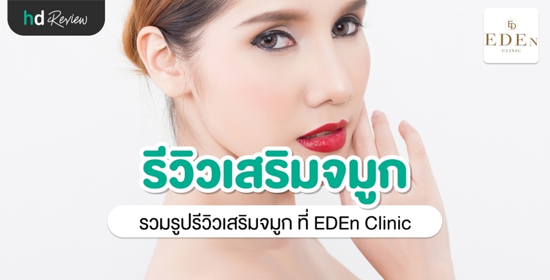 รีวิว เสริมจมูก ที่ E-Den Clinic