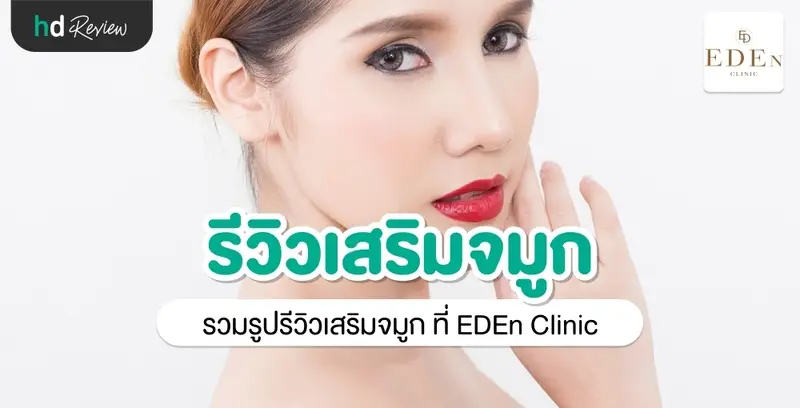 รีวิว เสริมจมูก ที่ E-Den Clinic
