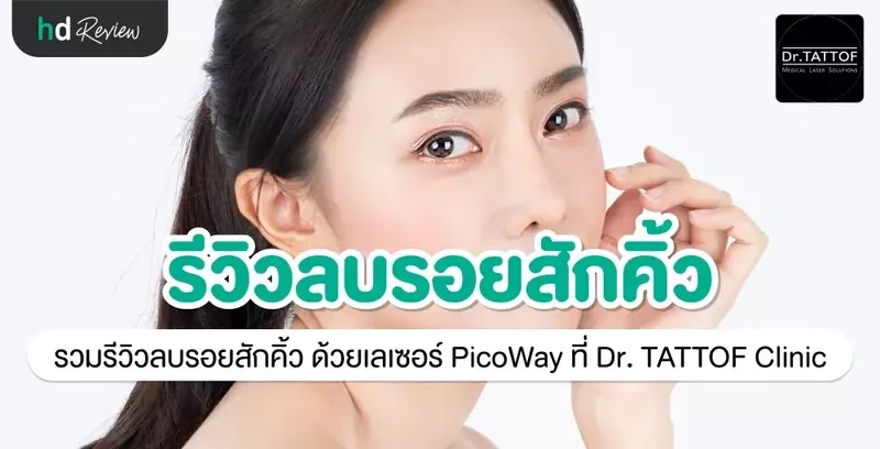 รีวิว ลบรอยสักคิ้ว ด้วยเลเซอร์ PicoWay ที่ Dr. TATTOF Clinic