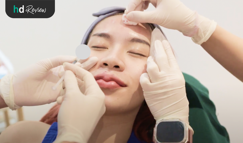 รีวิวโปรแกรมฉีดโบท็อกซ์ลดกรามและริ้วรอยบนใบหน้า ที่ Cher Clinic