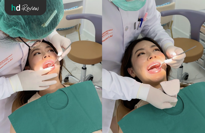 ตรวจสุขภาพฟันที่ Bangkok New Smile Dental Clinic