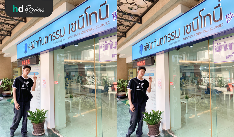 ผู้ใช้บริการทำรีเทนเนอร์แบบใส ที่ Zenitoni Dental Clinic