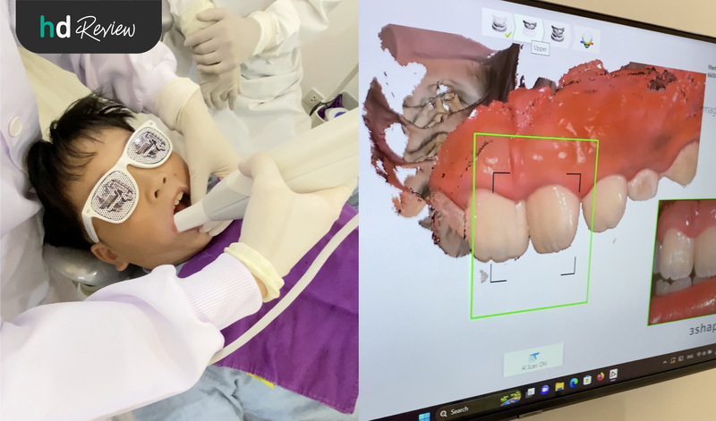 ขั้นตอนสแกนฟัน 3 มิติ