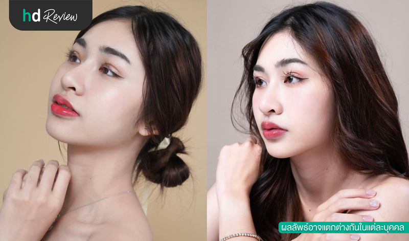 ผู้ใช้บริการทำตาสองชั้น ที่ Beproud Clinic