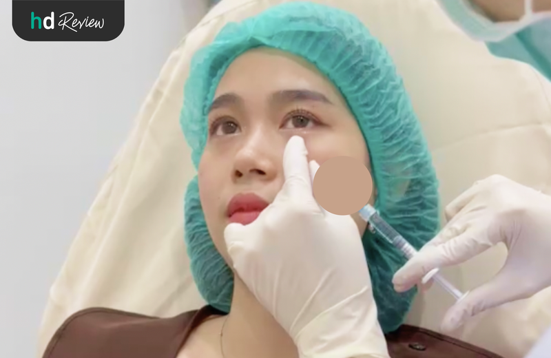 ขั้นตอนการฉีดฟิลเลอร์ใต้ตา