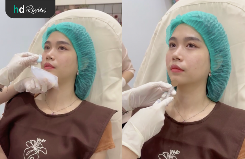 ขั้นตอนการฉีดฟิลเลอร์คาง