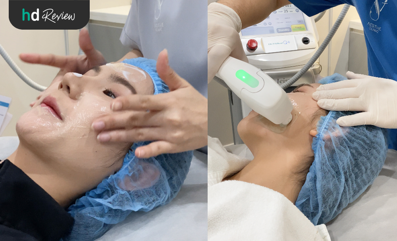 content review hifu ultracelq at aesthe clinic by chananschida jittrong 7
