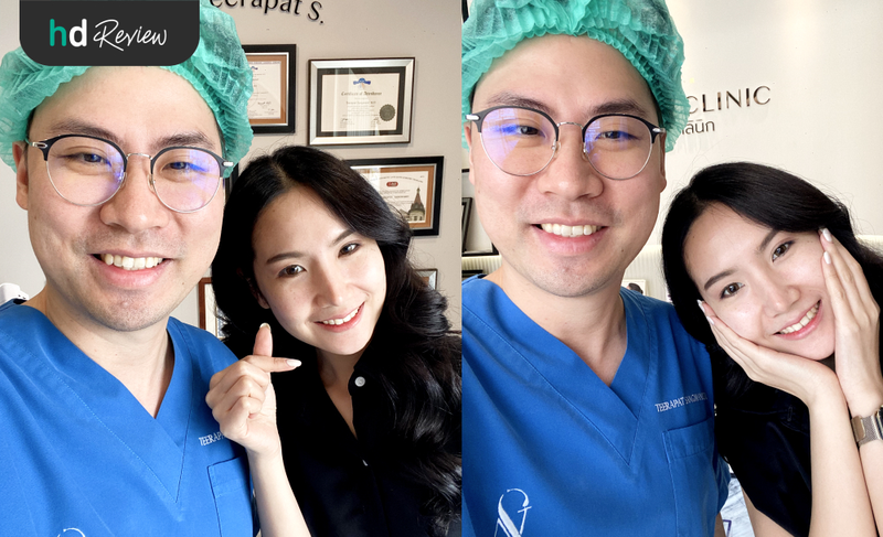 content review hifu ultracelq at aesthe clinic by chananschida jittrong 9