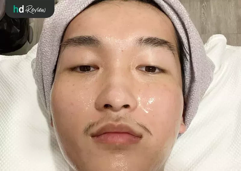ก่อนปรับผิวหน้าดูกระจ่างใส ด้วยเลเซอร์ Scanxel Fractional CO2 ที่ Agafar Medical Clinic