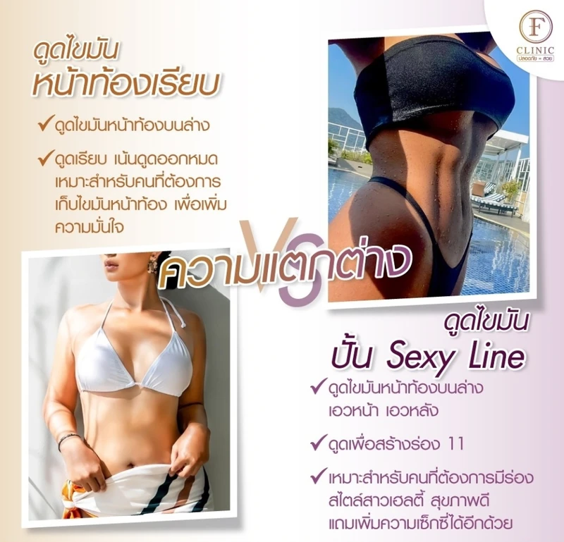 เปรียบเทียบการดูดไขมัน Sexy Line กับดูดไขมันทั่วไป