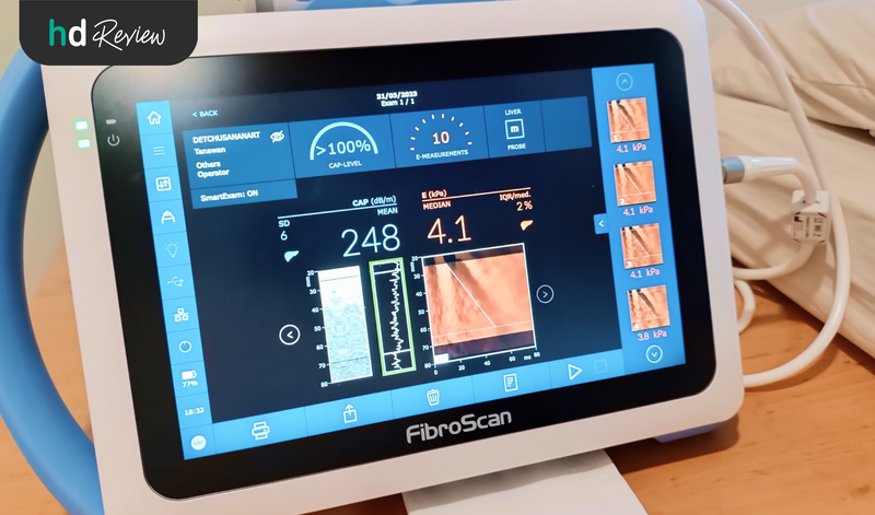 Fibroscan คืออะไร?