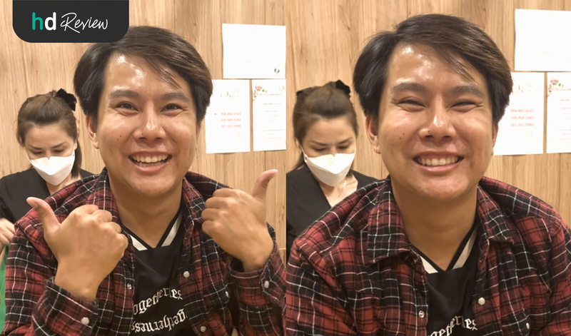 ผลลัพธ์หลังเลเซอร์หนวด