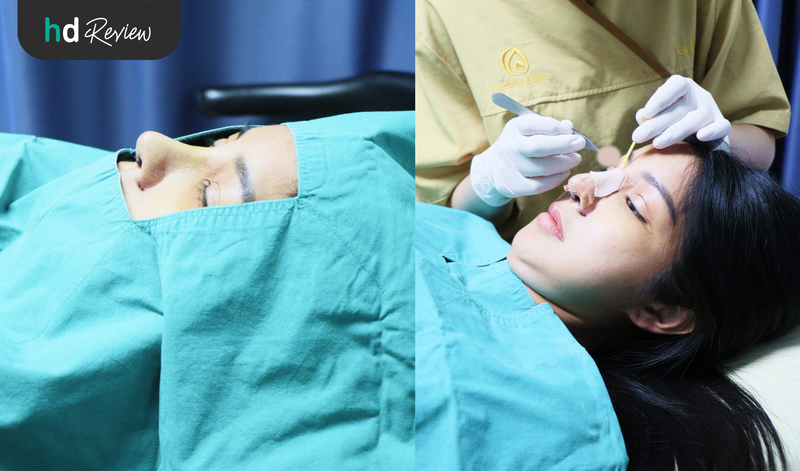 ขั้นตอนการแก้จมูก ที่ Century Health Clinic