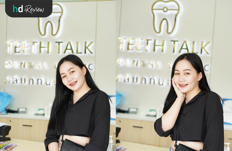 อยากจัดฟัน แนะนำที่ Teeth Talk Dental Clinic