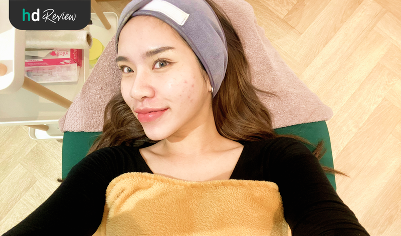 ขั้นตอนลดรอยดำจากสิว ด้วยโปรแกรม Pico Laser