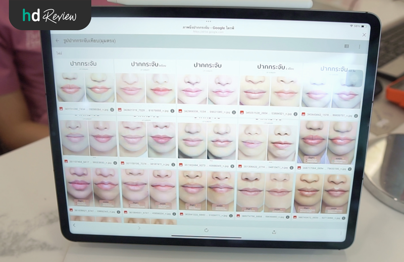 ทำปากกระจับ ที่ Better Me Clinic By Dr. Chanya ดีไหม?