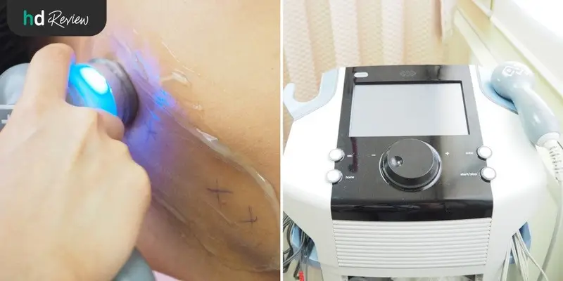 รีวิวทำกายภาพบำบัด รักษาอาการปวดไหล่ ออฟฟิศซินโดรม ที่ Newton Em Physiotherapy Clinic