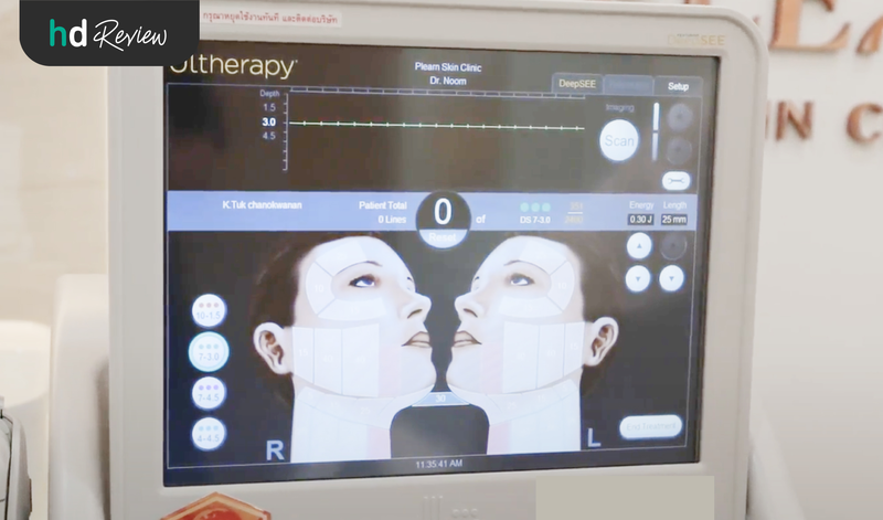 Ultherapy SPT คืออะไร?
