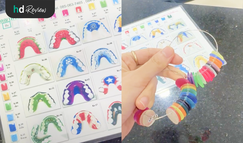 รีเทนเนอร์แบบลวด สีไหนสวย?
