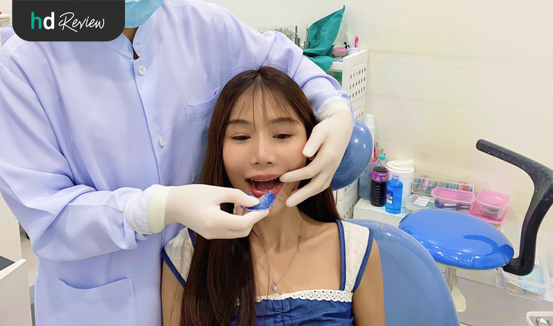 ขั้นตอนการทำรีเทนเนอร์