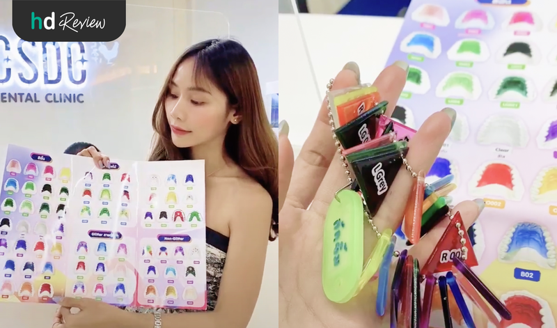 ทำรีเทนเนอร์แบบลวด สลักชื่อบนรีเทนเนอร์ได้