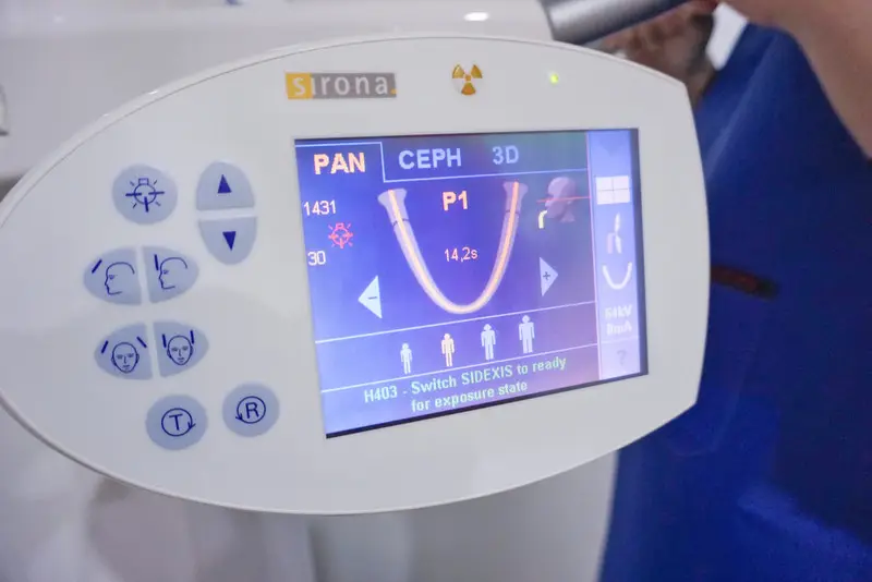 รีวิว ศูนย์ทันตกรรม APEX Dental Center (สาขาเพลินจิต) 20