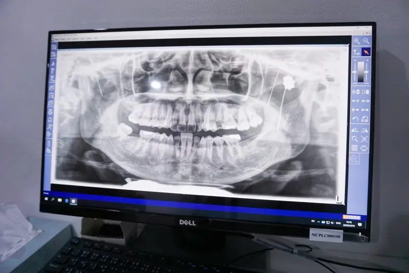 รีวิว ศูนย์ทันตกรรม APEX Dental Center (สาขาเพลินจิต) 22
