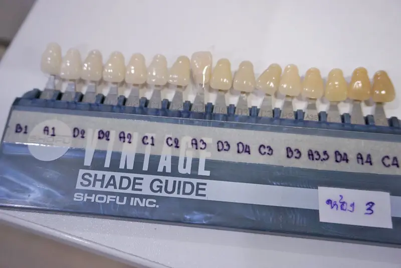 รีวิว ศูนย์ทันตกรรม APEX Dental Center (สาขาเพลินจิต) 4