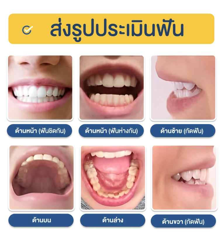 วิธีถ่ายรูปประเมินฟัน