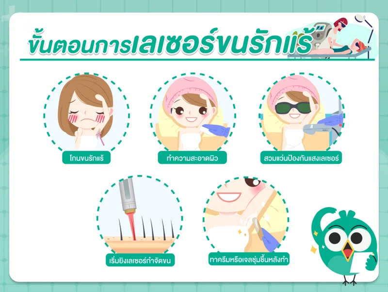 ขั้นตอนการเลเซอร์ขนรักแร้