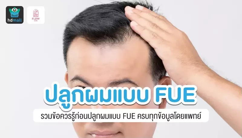 รวมข้อควรรู้ก่อนปลูกผมแบบ FUE แก้ปัญหาผมร่วง ผมบาง ศีรษะล้าน